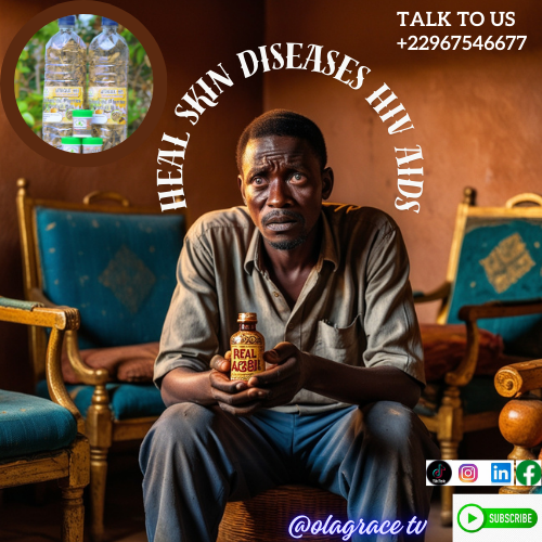 Heal skin diseases HIV AIDS