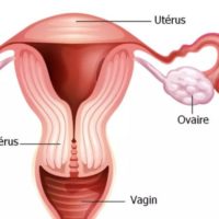 Blocked Fallopian Tubes Natural Treatment