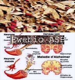 Plants To Cure Alzheimer&rsquo;s Disease