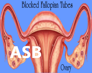 10 Recipes to Unclog Fallopian Tubs