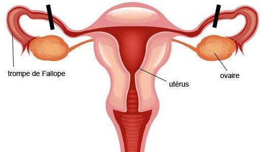 Blocked Fallopian Tubes : How to Unclog Fallopian Tubes With Ginger