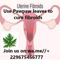 Shrink fibroids with pawpaw