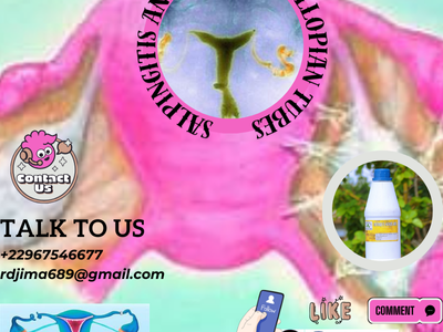 Salpingitis and Blocked Fallopian Tubes
